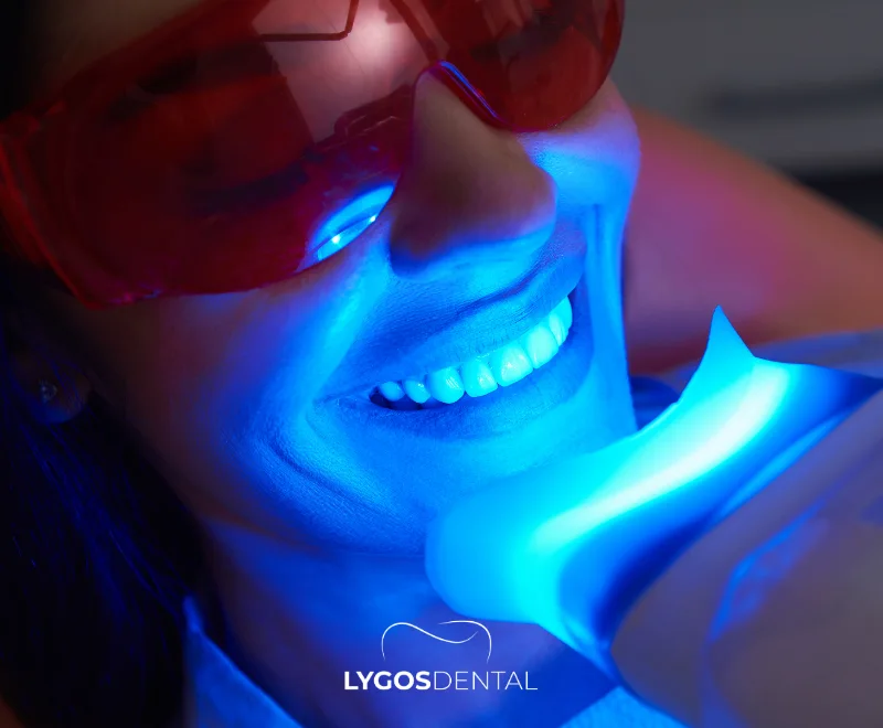 In-Office Laser Teeth Whitening Process and Prices