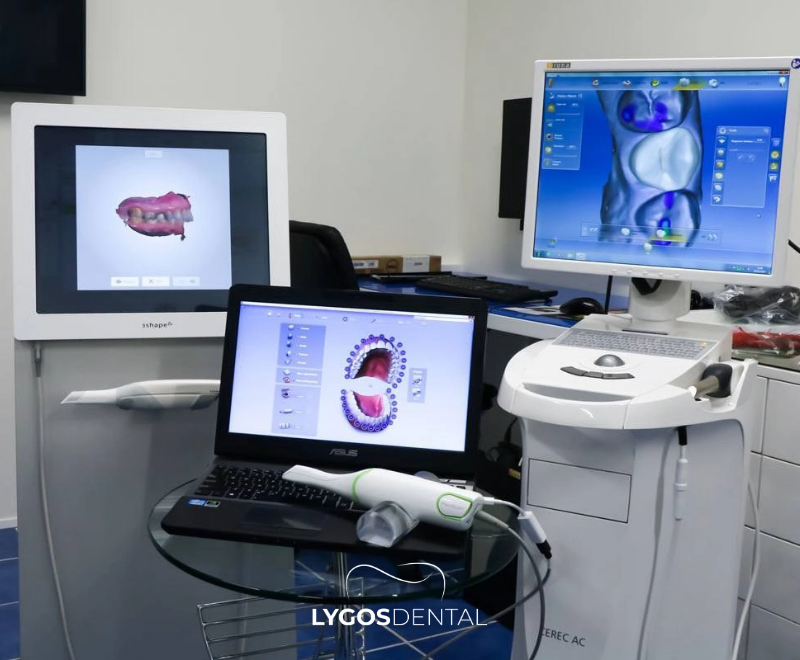 What is CAD/CAM Technology?