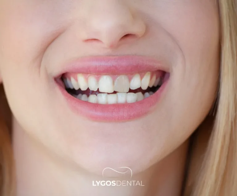 Who Is Suitable for Zirconium Crowns?