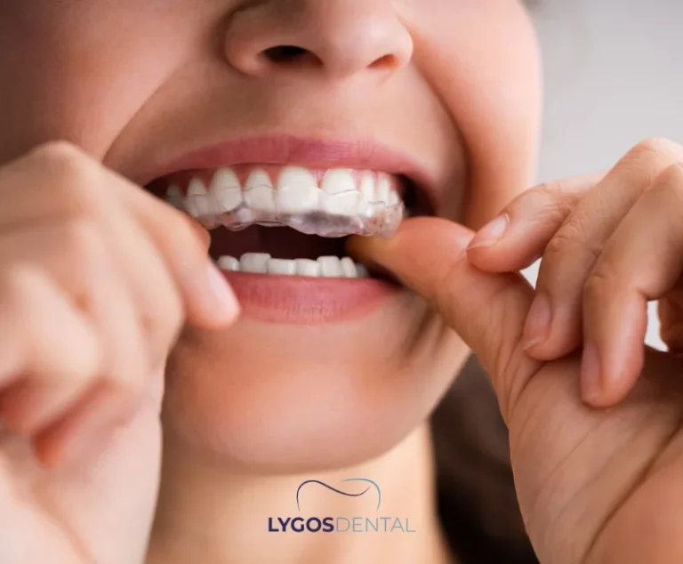 The Effects of Stress on Dental Health | LYGOS DENTAL