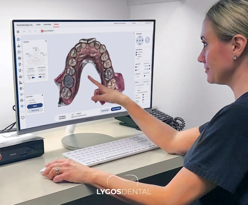 Why Are Dental Crowns So Expensive? | LYGOS DENTAL 1 Why Are Dental Crowns So Expensive? | LYGOS DENTAL