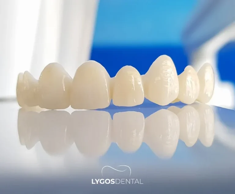 Why Are Dental Crowns So Expensive? | LYGOS DENTAL 2 Why Are Dental Crowns So Expensive? | LYGOS DENTAL