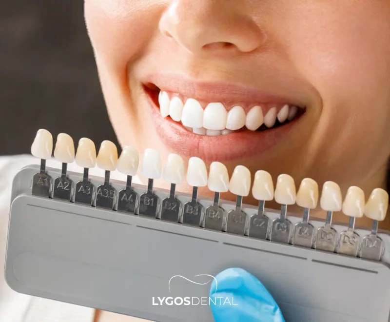 Turkey Dental Veneer Prices 2026 | LYGOS DENTAL