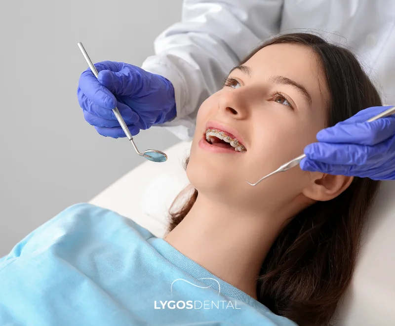 Things to Consider During Orthodontic Treatment | LYGOS DENTAL