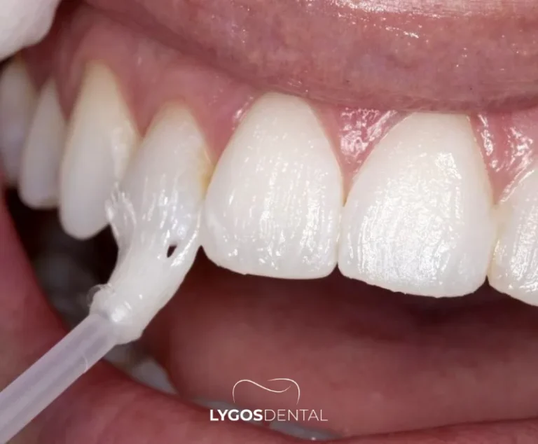Best Dentist in Bahçelievler | LYGOS DENTAL
