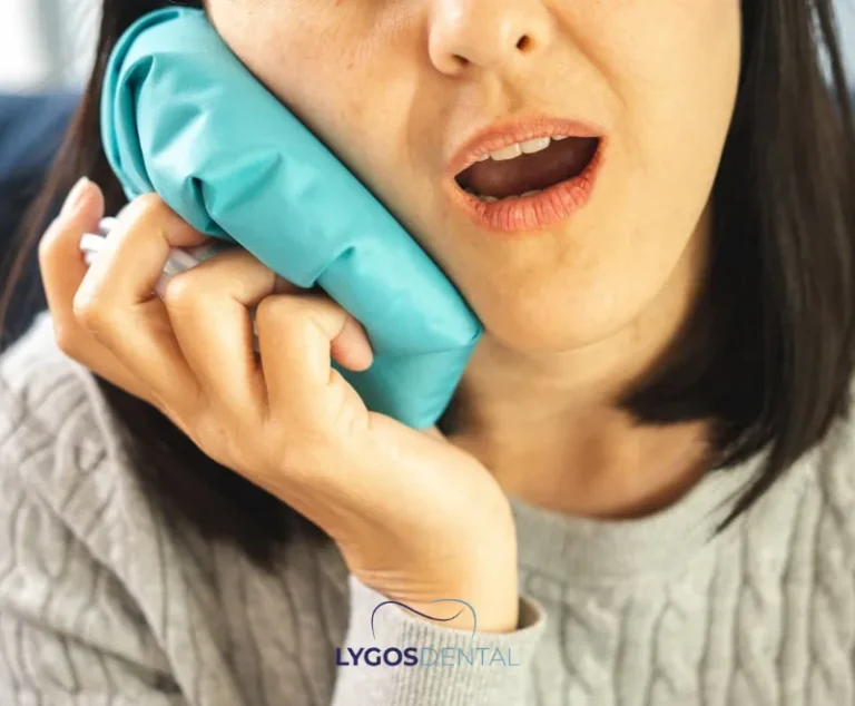 Swelling After Wisdom Tooth Extraction | LYGOS DENTAL 20 Swelling After Wisdom Tooth Extraction | LYGOS DENTAL