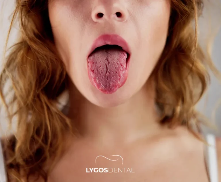 Effects of Thyroid Disorders on Dental Health | LYGOS DENTAL 17 Effects of Thyroid Disorders on Dental Health | LYGOS DENTAL