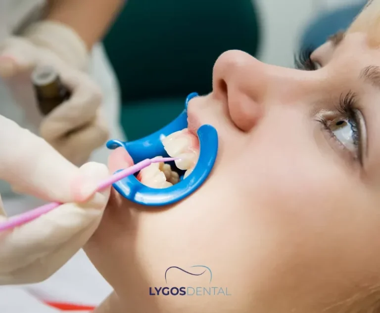 Sensitivity After Zirconium Crowns | LYGOS DENTAL 2 Sensitivity After Zirconium Crowns | LYGOS DENTAL