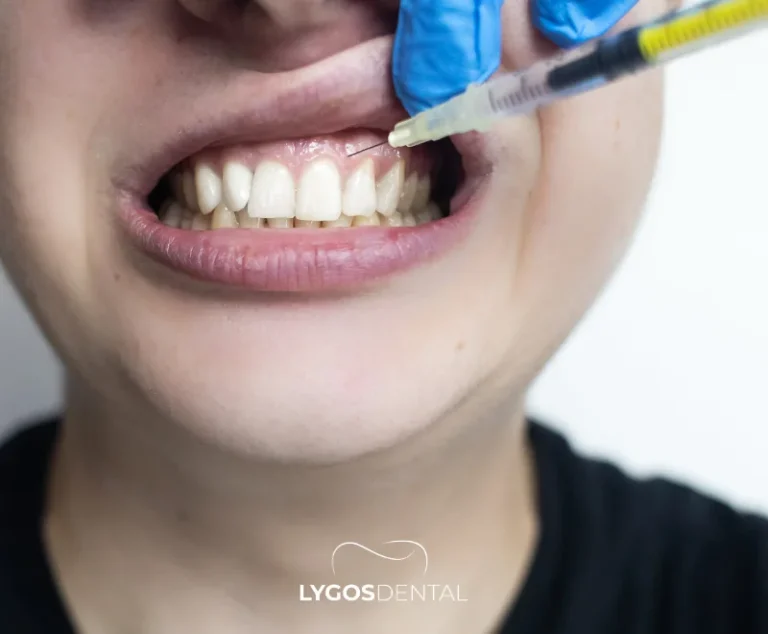Use of Stem Cells in Dental Treatments | LYGOS DENTAL 5 Use of Stem Cells in Dental Treatments | LYGOS DENTAL