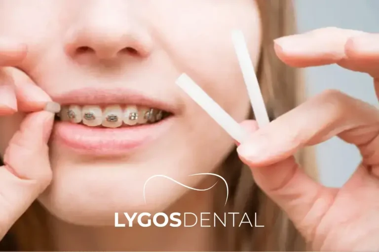 What Is Dental Wax and How to Use It? | LYGOS DENTAL 6 Common Mistakes to Avoid