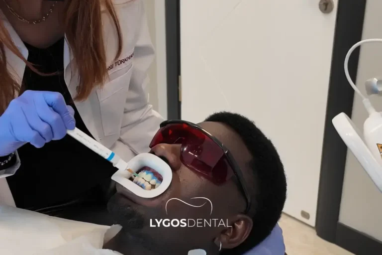 How tooth whitening actually works