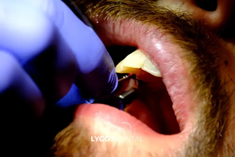 The Way Lygos Dental Approaches Treatment