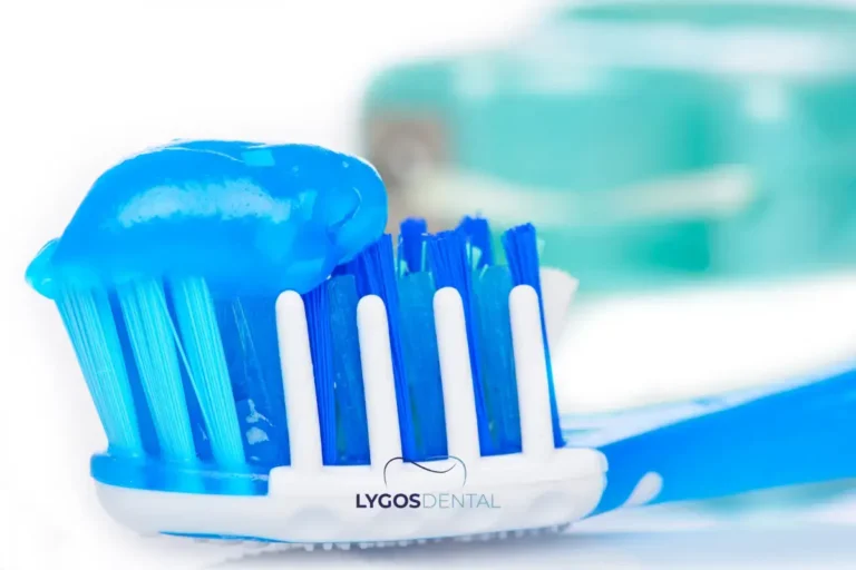 Taking Care of a Temporary Filling