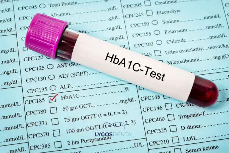 Healing and Aftercare for Diabetic Patients