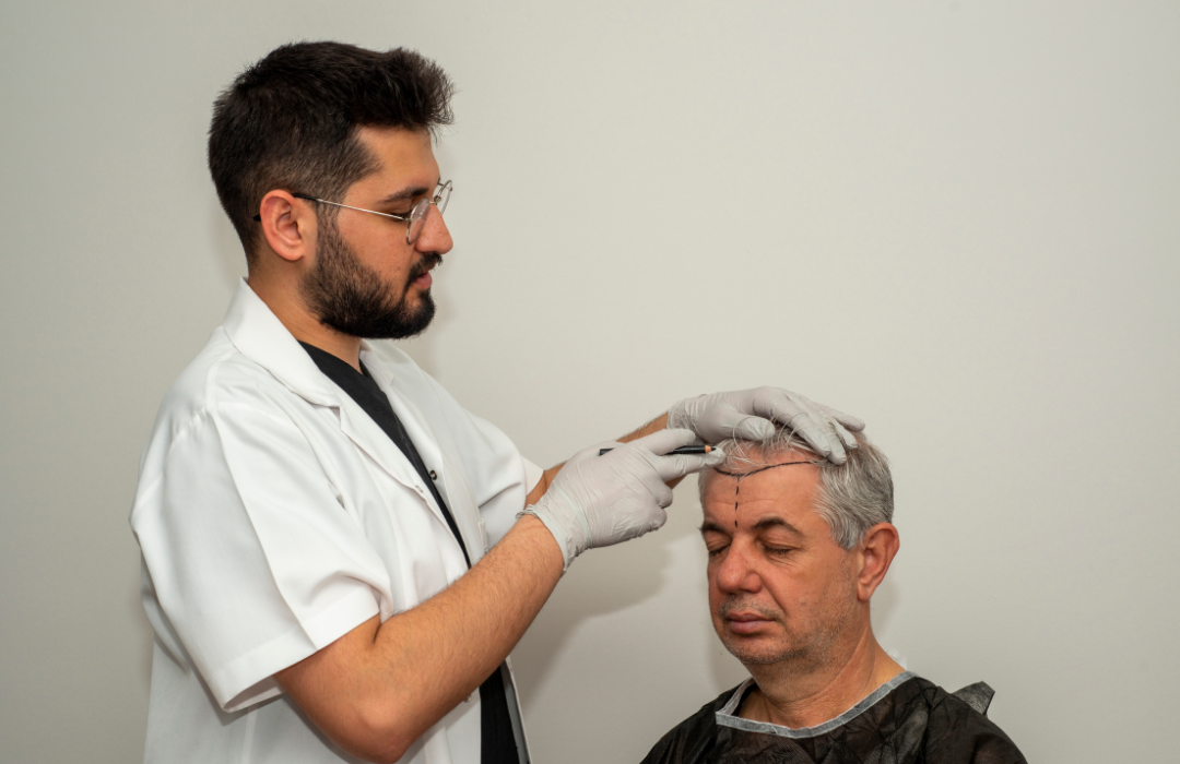 hair transplant costs