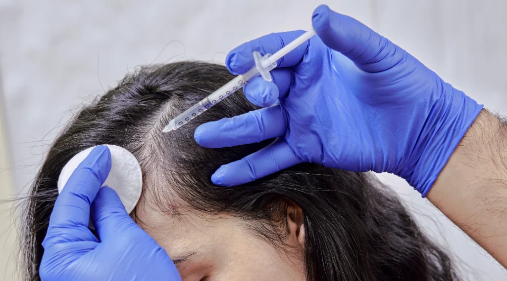 mesotherapy treatments