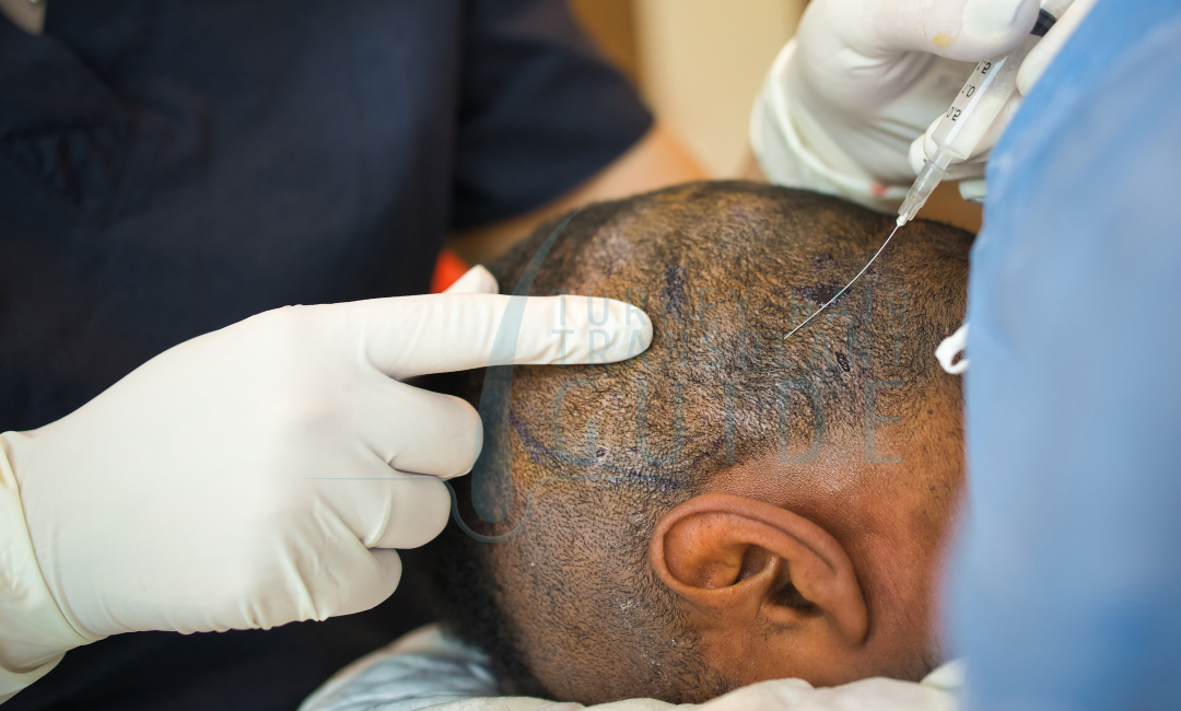 local anesthesia and comfort