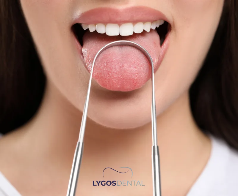 How Does Using a Tongue Cleaner Affect Dental Health?
