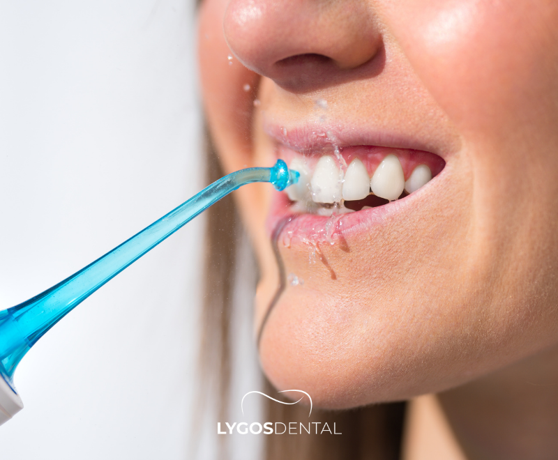 Fio dental ou irrigador bucal | LYGOS DENTAL