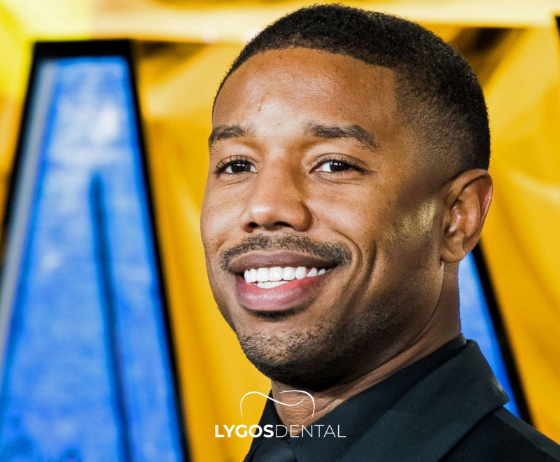 Michael B. Jordan Teeth Veneers