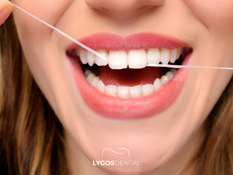 Why Do I Need to Floss | LYGOS DENTAL